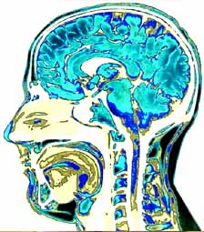 Tuberous sclerosis (TS) is a hereditary neurological condition that, although rare, is linked with Autism and the autism spectrum